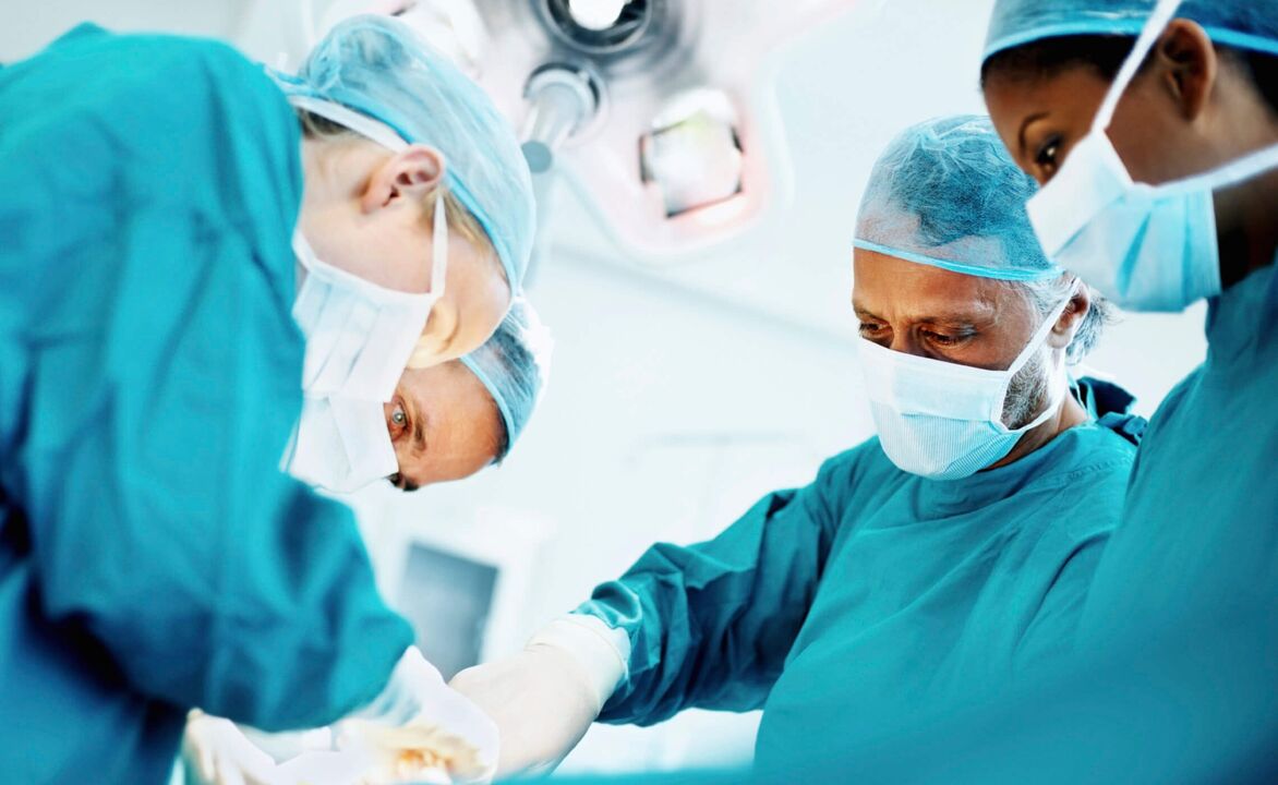 外科医生通过手术增大阴茎的过程。